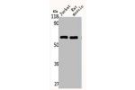 Western Blot analysis of Jurkat RAT-MUSCLE cells using CYP4Z1/2 Polyclonal Antibody
