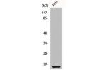 Western Blot analysis of A549 cells using Cystatin 11 Polyclonal Antibody