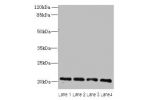 Western blot<br />
All lanes: ADP-ribosylation factor 6 antibody at 10ug/ml<br />
Lane 1 : MCF7 whole cell lysate<br />
Lane 2 : 293T whole cell lysate<br />
Lane 3 : A431 whole cell lysate<br />
Lane 4 : Rat liver tissue<br />
Secondary<br />
Goat polycl