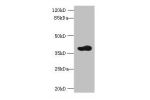 Western blot<br />
All lanes:ARFIP2 antibody at 2ug/ml+mouse brain tissue<br />
Secondary<br />
Goat polyclonal to rabbit at 1/10000 dilution<br />
Predicted band size: 38,30,34 kDa<br />
Observed band size: 38 kDa<br />
