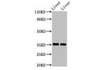 Western Blot<br />
Positive WB detected in:Mouse liver tissue,Rat liver tissue<br />
All lanes:ARG1 antibody at 2.8