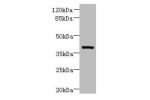 Western blot<br />
All lanes: Arg2 antibody at 10ug/ml+ Jurkat whole cell lysate<br />
Goat polyclonal to rabbit at 1/10000 dilution<br />
Predicted band size: 39 kDa<br />
Observed band size: 39 kDa<br />