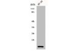 Western Blot analysis of HT29 cells using Cystatin A Polyclonal Antibody