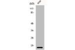 Western Blot analysis of A549 cells using Cystatin B Polyclonal Antibody