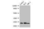 Western Blot<br />
Positive WB detected in:Jurkat whole cell lysate,Raji whole cell lysate,THP-1 whole cell lysate<br />
All lanes: ARHGDIB antibody at 3ug/ml<br />
Secondary<br />
Goat polyclonal to rabbit IgG at 1/50000 dilution<br />
Predicted band siz