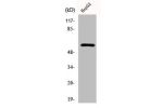 Western Blot analysis of 293 cells using Dab1 Polyclonal Antibody