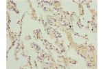 Immunohistochemistry of paraffin-embedded human lung tissue using CSB-PA002069ESR1HU at dilution 1:100