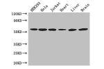 Western Blot<br />
Positive WB detected in:HEK293 whole cell lysate,Hela whole cell lysate,Jurkat whole cell lysate,Mouse heart tissue,Mouse liver tissue,Mouse brain tissue<br />
All lanes: ARIH2 antibody at 3ug/ml<br />
Secondary<br />
Goat polyclonal to