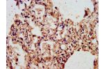 IHC image of CSB-PA002070LA01HU diluted at 1:300 and staining in paraffin-embedded human lung tissue performed on a Leica BondTM system. After dewaxing and hydration, antigen retrieval was mediated by high pressure in a citrate buffer (pH 6.0). Section wa