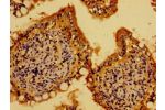 Immunohistochemistry of paraffin-embedded human small intestine tissue using CSB-PA002086LA01HU at dilution of 1:100