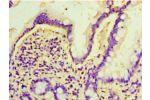 Immunohistochemistry of paraffin-embedded human small intestine using CSB-PA002087LA01HU at dilution 1:100