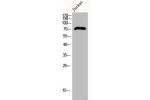 Western Blot analysis of Jurkat cells using DCAMKL3 Polyclonal Antibody