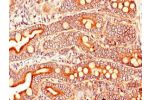 Immunohistochemistry of paraffin-embedded human small intestine tissue using CSB-PA002096LA01HU at dilution of 1:100