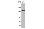 Western Blot analysis of HepG2 cells using DDX8 Polyclonal Antibody
