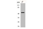 Western Blot analysis of 293 cells using Dematin Polyclonal Antibody