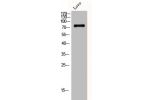 Western Blot analysis of Lovo cells using DGK-a Polyclonal Antibody