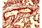 IHC image of CSB-PA002130LA01HU diluted at 1:300 and staining in paraffin-embedded human lung tissue performed on a Leica BondTM system. After dewaxing and hydration, antigen retrieval was mediated by high pressure in a citrate buffer (pH 6.0). Section wa