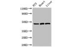 Western Blot<br />
Positive WB detected in:PC3 whole cell lysate,Rat heart tissue,Rat liver tissue<br />
All lanes:ARRB2 antibody at 3.5
