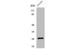 Western Blot analysis of COLO205 cells using DHRS2 Polyclonal Antibody
