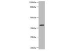 Western blot<br />
All lanes: Arylsulfatase B antibody at 2ug/ml+mouse brain tissue<br />
Secondary<br />
Goat polyclonal to Rabbit lgG at 1/15000 dilution<br />
Predicted band size: 60,46 kDa<br />
Observed band size: 40 kDa<br />