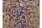 IHC image of CSB-PA002146LA01HU diluted at 1:400 and staining in paraffin-embedded human liver tissue performed on a Leica BondTM system. After dewaxing and hydration, antigen retrieval was mediated by high pressure in a citrate buffer (pH 6.0). Section w