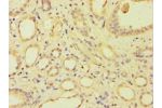Immunohistochemistry of paraffin-embedded human kidney using CSB-PA002148ESR1HU at dilution 1:100