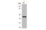 Western Blot analysis of 293 cells using Dlx-3 Polyclonal Antibody