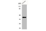 Western Blot analysis of COLO205 cells using Dlx-4 Polyclonal Antibody