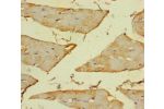 Immunohistochemistry of paraffin-embedded human skeletal muscle tissue using CSB-PA002170EA01HU at dilution of 1:100