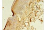 Immunohistochemistry of paraffin-embedded human skin tissue using CSB-PA002171LA01HU at dilution 1:100