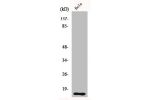 Western Blot analysis of HeLa cells using DOC-1 Polyclonal Antibody