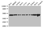 Western Blot<br />
Positive WB detected in:Hela whole cell lysate,HEK293 whole cell lysate,Jurkat whole cell lysate,Mouse heart tissue,Mouse liver tissue,Mouse lung tissue,Mouse kidney tissue,Mouse brain tissue,Mouse stomach tissue<br />
All lanes: ASCC1 