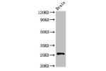 Western Blot<br />
Positive WB detected in:Rat brain tissue<br />
All lanes:ASCL1 antibody at 3