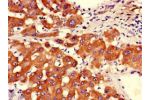 Immunohistochemistry of paraffin-embedded human liver tissue using CSB-PA002208LA01HU at dilution of 1:100