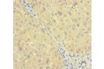 Immunohistochemistry of paraffin-embedded human liver tissue using CSB-PA002213LA01HU at dilution of 1:100