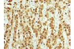 Immunohistochemistry of paraffin-embedded human kidney using CSB-PA002218ESR1HU at dilution 1:100