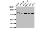 Western Blot<br />
Positive WB detected in:Hela whole cell lysate,SH-SY5Y whole cell lysate,Mouse skeletal muscle tissue,Rat heart tissue,Rat liver tissue<br />
All lanes:ASNS antibody at 2.7