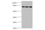 Western blot<br />
All lanes:Aspartyl/asparaginyl beta-hydroxylase antibody at 2ug/ml<br />
Lane 1:mouse stomach tissue<br />
Lane 2:jurkat whole cell lysate<br />
Lane 3:HepG2 whole cell lysate<br />
Secondary<br />
Goat polyclonal to rabbit at 1/10000 d