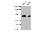 Western Blot<br />
Positive WB detected in:Mouse brain tissue,Hela whole cell lysate<br />
All lanes: ASS1 antibody at 3ug/ml<br />
Secondary<br />
Goat polyclonal to rabbit IgG at 1/50000 dilution<br />
Predicted band size: 47 kDa<br />
Observed band siz