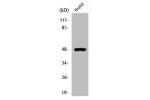 Western Blot analysis of COLO205 cells using E2F-2 Polyclonal Antibody