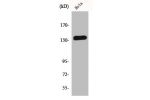 Western Blot analysis of HeLa cells using E-cadherin Polyclonal Antibody