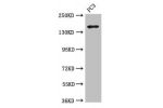 Western Blot<br />
Positive WB detected in:PC3 whole cell lysate<br />
All lanes:ASTN2 antibody at 3.4