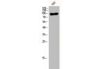 Western Blot analysis of VEC cells using EF-2 Polyclonal Antibody