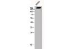 Western Blot analysis of AD293 cells using EGFR Polyclonal Antibody