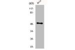 Western Blot analysis of Jurkat cells using Egr-2 Polyclonal Antibody