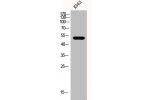 Western Blot analysis of K562 cells using eIF2B? Polyclonal Antibody