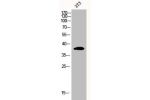 Western Blot analysis of 3T3 cells using eIF2a Polyclonal Antibody