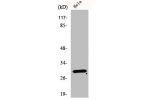 Western Blot analysis of HeLa cells using eIF3K Polyclonal Antibody