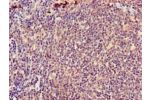 Immunohistochemistry of paraffin-embedded human lymph node tissue using CSB-PA002299LA01HU at dilution of 1:100