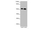 Western blot<br />
All lanes: ATMIN antibody at 1.53ug/ml<br />
Lane 1 : Hela whole cell lysate<br />
Lane 2 : HepG-2 whole cell lysate<br />
Secondary<br />
Goat polyclonal to Rabbit IgG at 1/10000 dilution<br />
Predicted band size: 89,73 kDa<br />
Obse